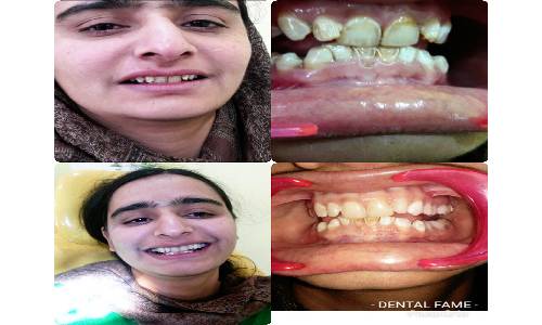 Dental Success 2