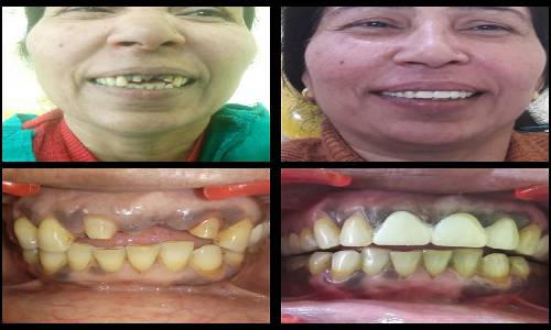Dental Success 2