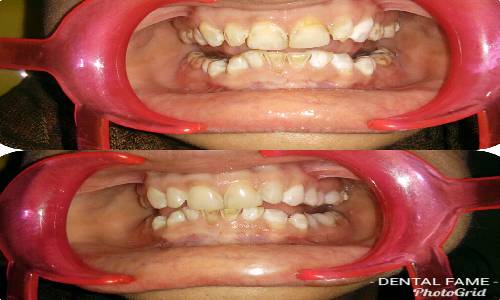 Dental Success 2